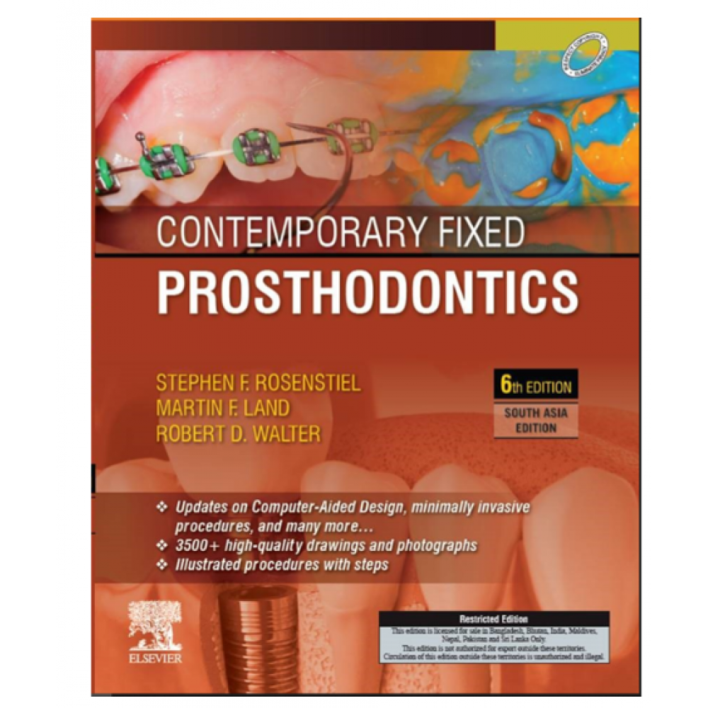 Contemporary Fixed Prosthodontics;2nd(South Asia) Edition